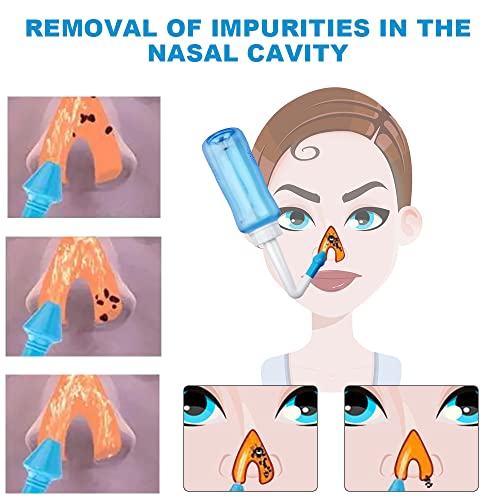 Neti Pot Sinus Rinse Bottle & Nasal Wash Kit - BPA-Free 300ML with 40 Salt Packets