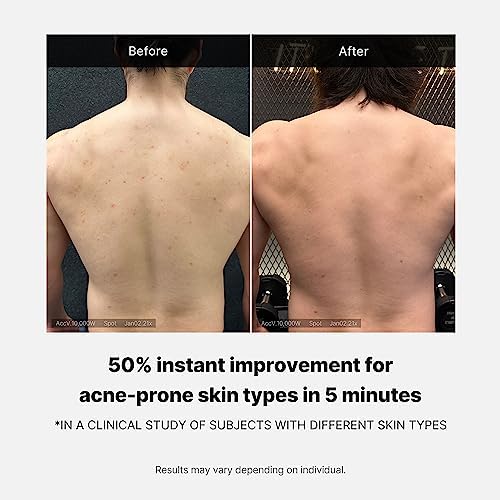 Medicube Red Acne Treatment Body Wash with Salicylic Acid & Niacinamide (K-Beauty)