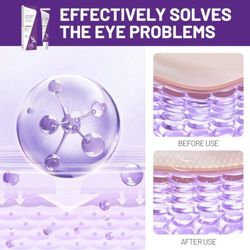 Retinol & Niacinamide Eye Cream for Fine Lines, Wrinkles & Dark Circles