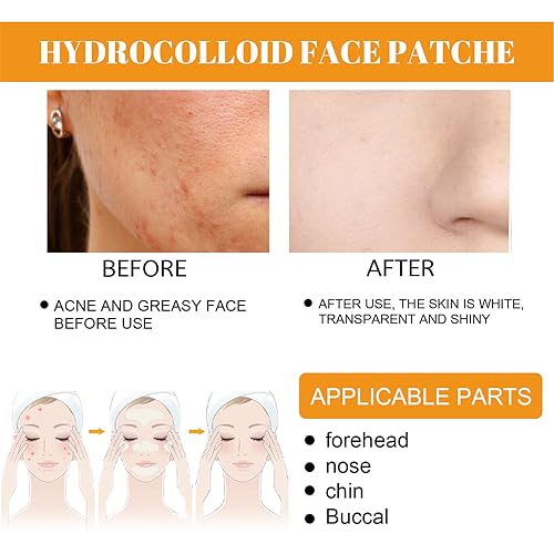 Hydrocolloid Face Mask - Large Pimple Patches for Zit Breakouts, Vegan & Cruelty-Free