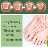 WINDALY® Premium Anti-Fungus Nail Treatment Oil for Toenails (50ml)