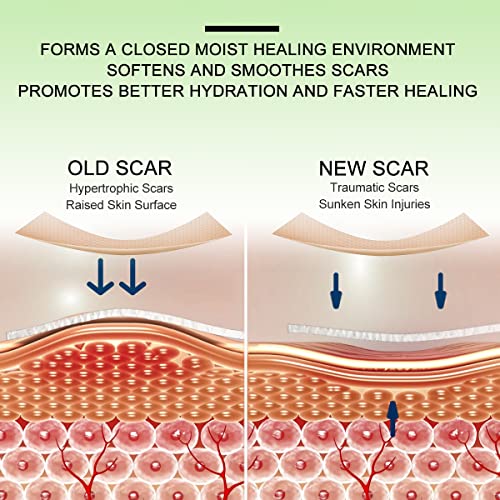 Medical Grade Silicone Scar Sheets for Scar Removal - 1.8 x 157 inches