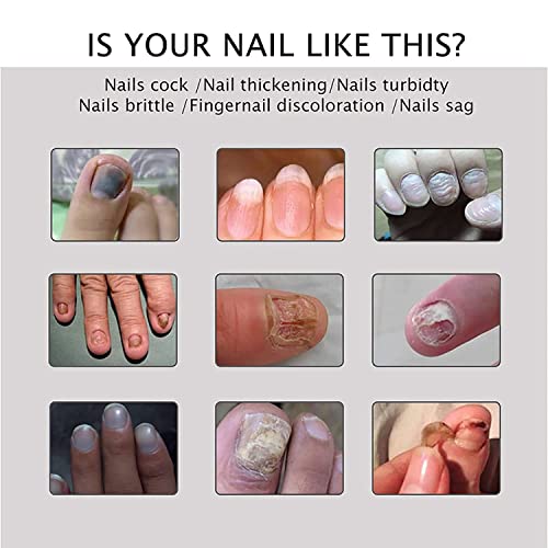 Flyles Nail Repair Gel for Damaged Nails, 2 Pack