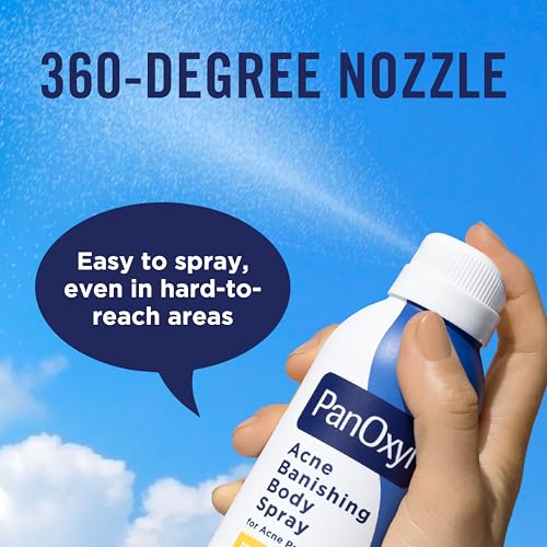 PanOxyl Acne Banishing Body Spray with 2% Salicylic Acid - 6 Oz | Pimple Treatment Spray for Stubborn Breakouts