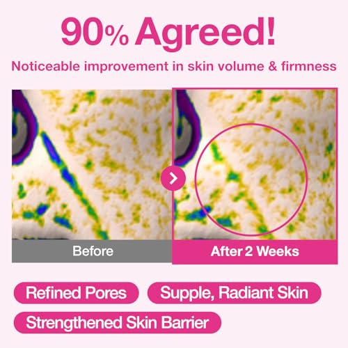 numbuzin No.2 Rose PDRN Overnight Collagen Face Mask – Firming & Hydrating Korean Mask for Elasticity & Minimized Pores (Pack of 4)