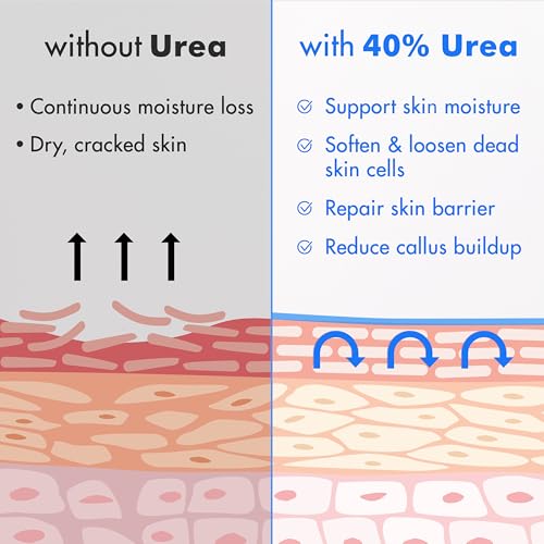Ebanel Urea Cream 40% with Salicylic Acid 2% for Dry, Cracked Skin