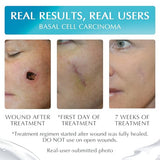 MyNewGel NewGel+E Advanced Vitamin E Silicone Gel