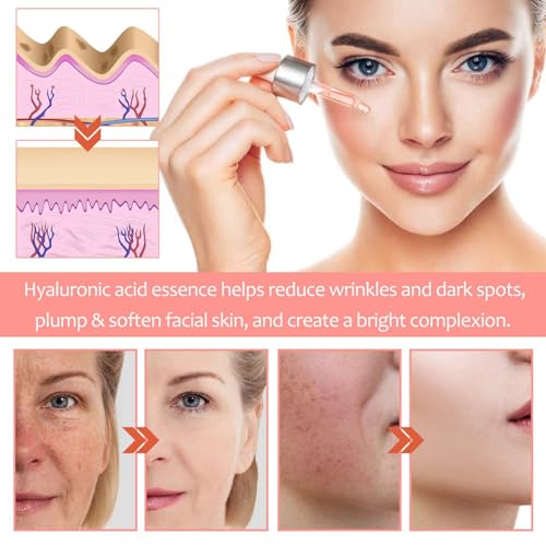 30% Vitamin C Serum with Hyaluronic Acid & Niacinamide - Anti-Aging Brightening Serum (1.41 fl oz)
