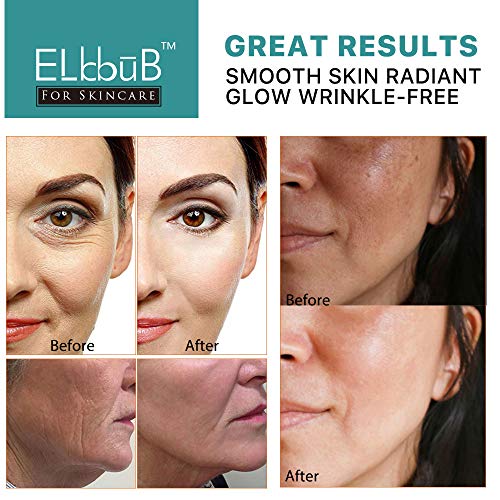 ELBBUB Retinol Serum - Anti Aging Retinol with Hyaluronic Acid & Vitamin E (2 Pack)