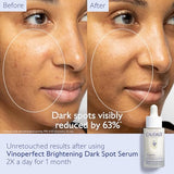 Caudalie Vinoperfect Brightening Dark Spot Serum Set -  Full Size + 2 Travel Sizes