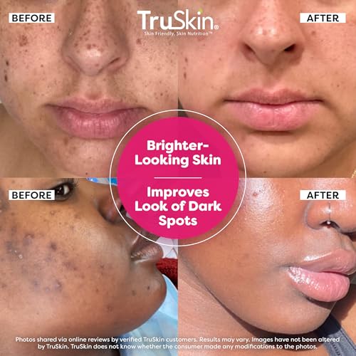 TruSkin Vitamin C Super Serum with Niacinamide, Retinol & Hyaluronic Acid - Anti-Aging & Brightening