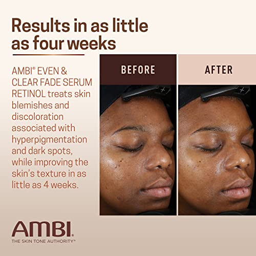 Ambi Even & Clear Fade Serum - Hydroquinone-Free Dark Spot Corrector with Retinol, Hyaluronic Acid, Niacinamide & Ceramides