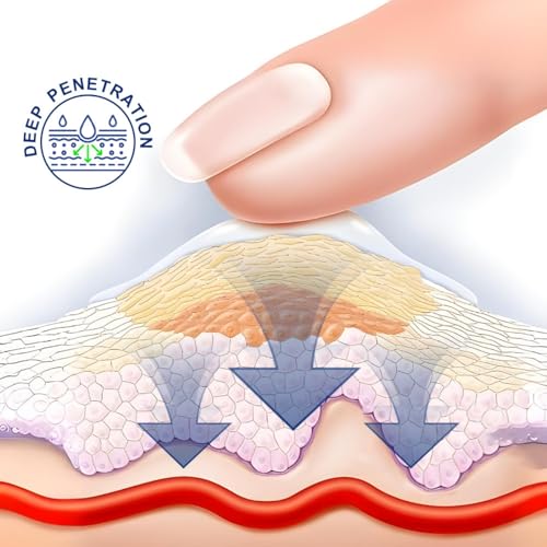 Dark Circle Reducing Eye Cream, 30g – Tired Eye Relief, Tightening & Hydration for Puffy Eyes & Bags