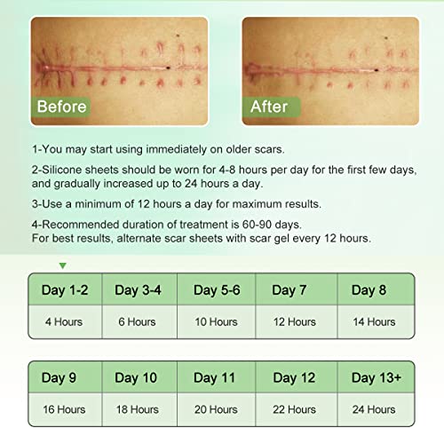 Medical Grade Silicone Scar Sheets for Scar Removal - 1.8 x 157 inches