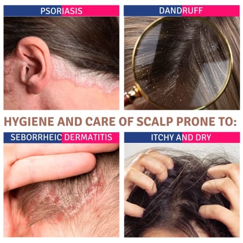 PsoriTIS 10% Urea Shampoo - For Seborrheic Scalp & Psoriasis Care - 120ml + Almond Milk Soap 25g