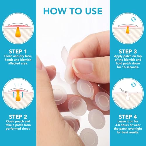 KASTWAVE Micropoint Acne Patch - 18 Patches with Advanced Anti-Acne Technology for Early Stage Blemishes
