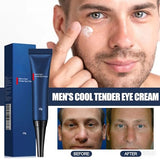 Retinol Under Eye Cream for Dark Circles, Puffy Eyes & Fine Lines - Fade Wrinkles & Improved Skin Texture