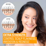 Neutrogena Scalp Therapy Anti-Dandruff Shampoo - Extra Strength Medicated Shampoo - 12oz