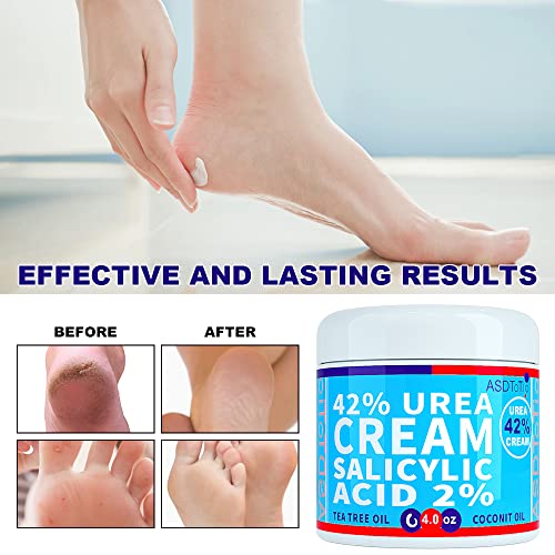 Premium 42% Urea Foot Cream with Salicylic Acid & Natural Oils - For Feet, Hands & Rough Skin