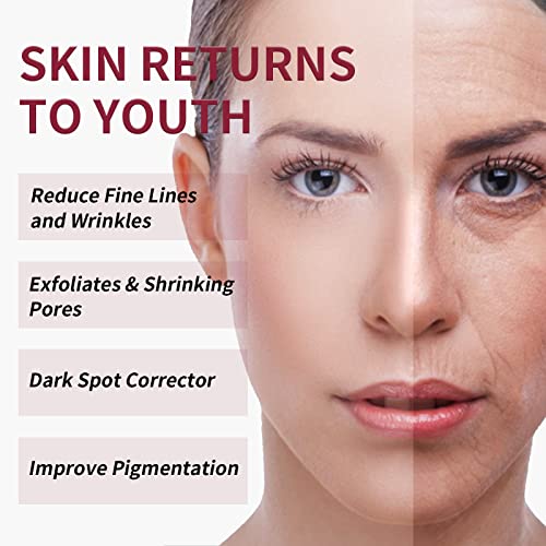 AHA 30% + BHA 2% Peeling Solution - Exfoliating Chemical Peel for Face | Salicylic Acid Exfoliant | 1 oz