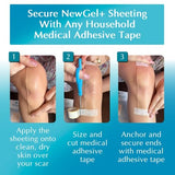 NewGel+ Silicone Gel Strips for Scar Management - Effective & Discreet