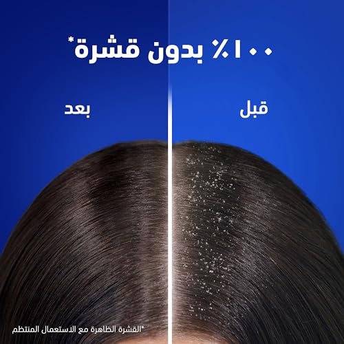 Head & Shoulders Total Care Anti-Dandruff Shampoo 400ml - Clinically Proven Dandruff Relief