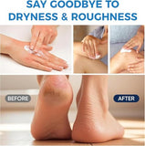 Urea Cream 42% + Salicylic Acid 2% - Foot & Hand Lotion for Dry Cracked Heels, Feet, Knees & Elbows - Callus Remover & Toenail Softener