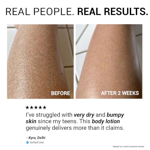 Sereko Urea Body Lotion with Avocado Oil | Detox & Exfoliation for Very Dry Skin