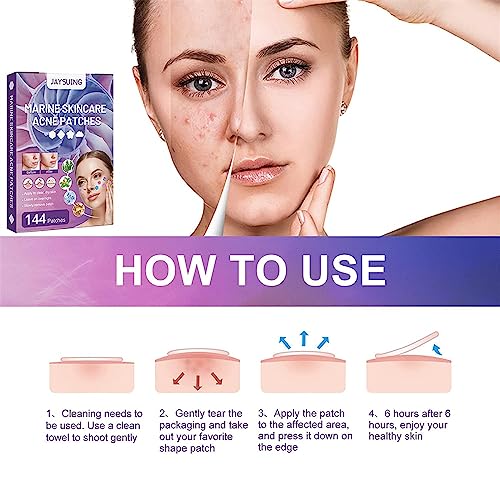 Acne Patches with Natural Green Algae Extract & Tea Tree Oil - Hydrocolloid Pimple Patches for Face, 144 Dots