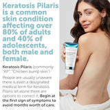 Keratosis Pilaris Body Lotion with Exfoliating AHA BHA & Glycolic Acid for Strawberry Legs Skin Care