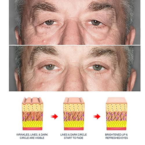 Retinol Under Eye Cream for Dark Circles, Puffy Eyes & Fine Lines - Fade Wrinkles & Improved Skin Texture