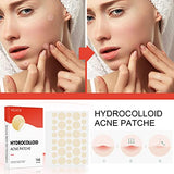 JDLYEVER Hydrocolloid Acne Patch - Invisible Makeup Closed Acne Patch, Waterproof & Breathable, 144 Patches
