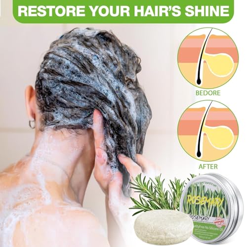 2Pack Rosemary Shampoo Bar for Hair Growth & Deep Cleansing - Anti Hair Loss Solid Shampoo Soap