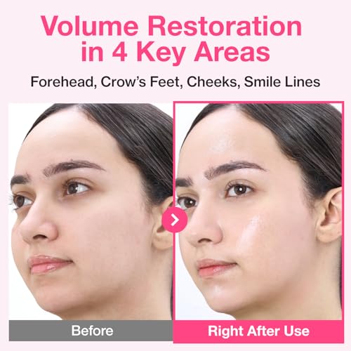 numbuzin No.2 Rose PDRN Collagen Plumping Sheet Mask – Hydrating & Firming Korean Face Mask for Brighter, Youthful Skin (Pack of 5)