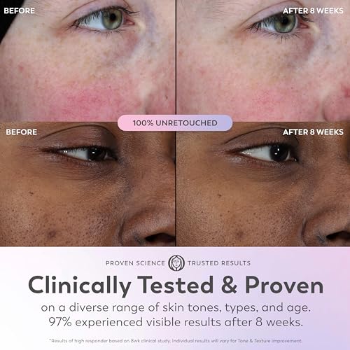 Olay Super Serum – Niacinamide, Vitamin C, Collagen Peptide & AHA Anti-Aging Serum 1.0 oz