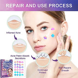 Acne Patches with Natural Green Algae Extract & Tea Tree Oil - Hydrocolloid Pimple Patches for Face, 144 Dots