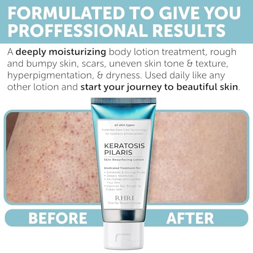 Keratosis Pilaris Body Lotion with Exfoliating AHA BHA & Glycolic Acid for Strawberry Legs Skin Care