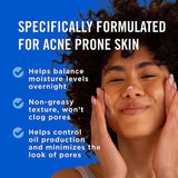 Goyazan Acne Foaming Wash - 4% Benzoyl Peroxide Maximum Strength - 6oz (2 Pack)