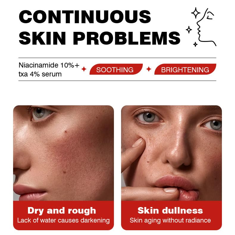 Niacinamide 10% + TXA 4% Serum - Glass Skin Clarifying Facial Serum