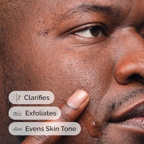 The Ordinary Salicylic Acid 2% Solution - 30ml | Exfoliating Treatment for Acne & Blemishes
