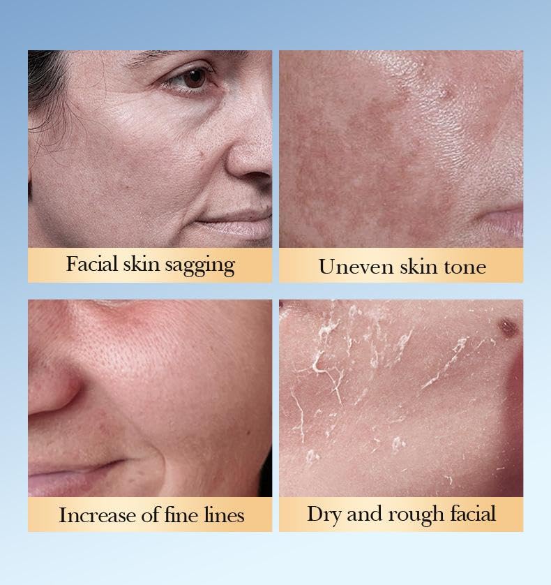 7% Glycolic Acid Facial Toner - Daily Exfoliating & Hydrating Solution