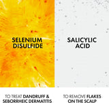 Vichy Dercos Anti-Dandruff Shampoo for Dry Hair (200ml)