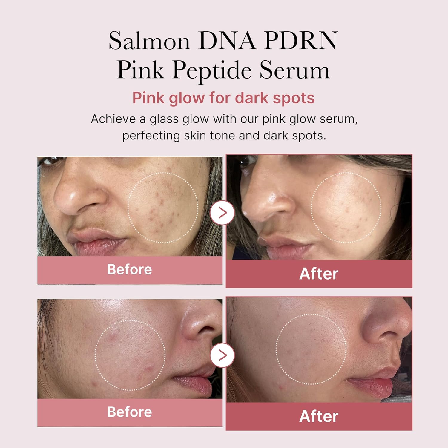سبراي سروم ميديكوب PDRN Pink Peptide  لترطيب البشرة وتوحيد لونها