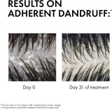 Vichy Dercos Anti-Dandruff Shampoo for Dry Hair (200ml)