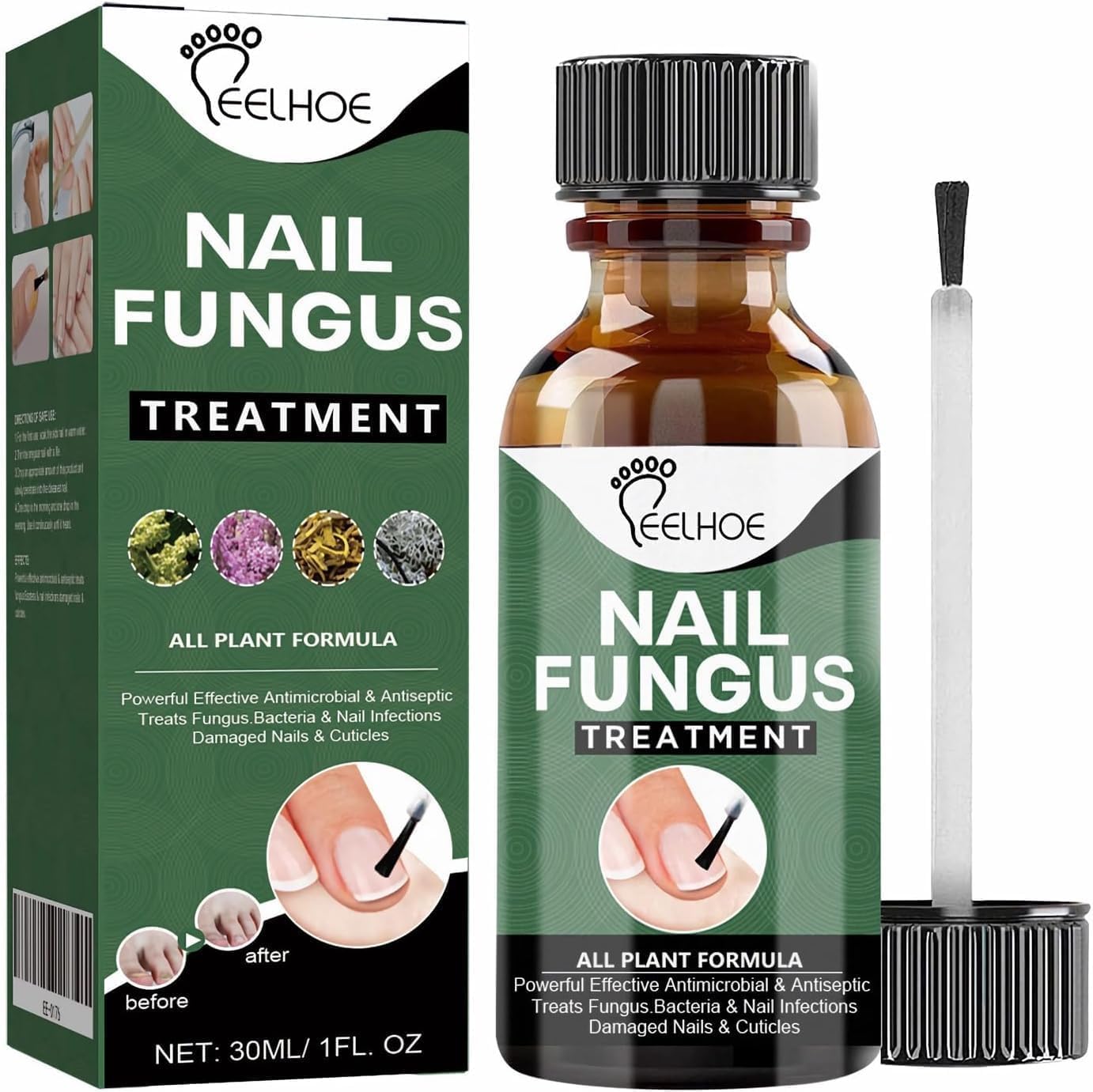 WINDALY® Premium Anti-Fungus Nail Treatment Oil for Toenails (50ml)