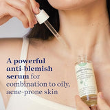Embryolisse Anti-Blemish Face Serum: Clear Skin Solution for Oily & Combination Skin