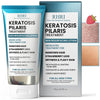 Keratosis Pilaris Body Lotion with Exfoliating AHA BHA & Glycolic Acid for Strawberry Legs Skin Care