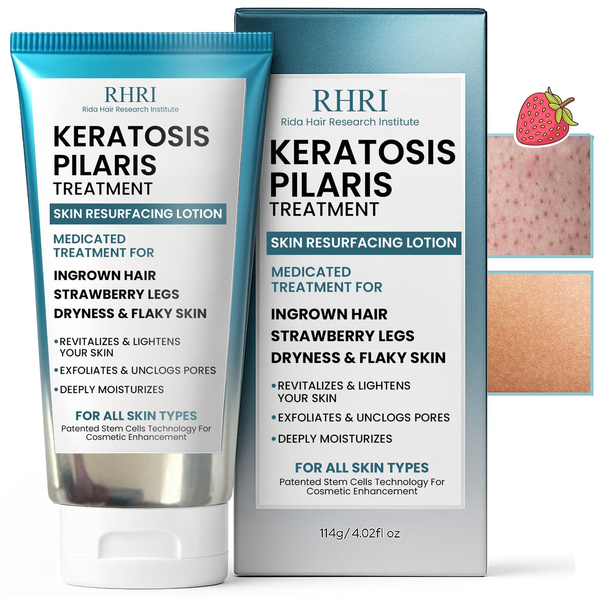 Keratosis Pilaris Body Lotion with Exfoliating AHA BHA & Glycolic Acid for Strawberry Legs Skin Care