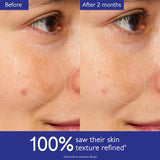 Caudalie Vinoperfect Brightening Glycolic Essence Toner - 100ml