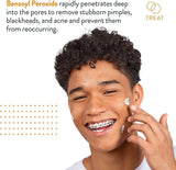 Maximum strength acne spot treatment cream for quick results.